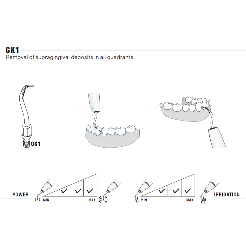 Universal tip for KaVo Sonicflex 2000N / 2003 and ECO S2 | Prophylaxis