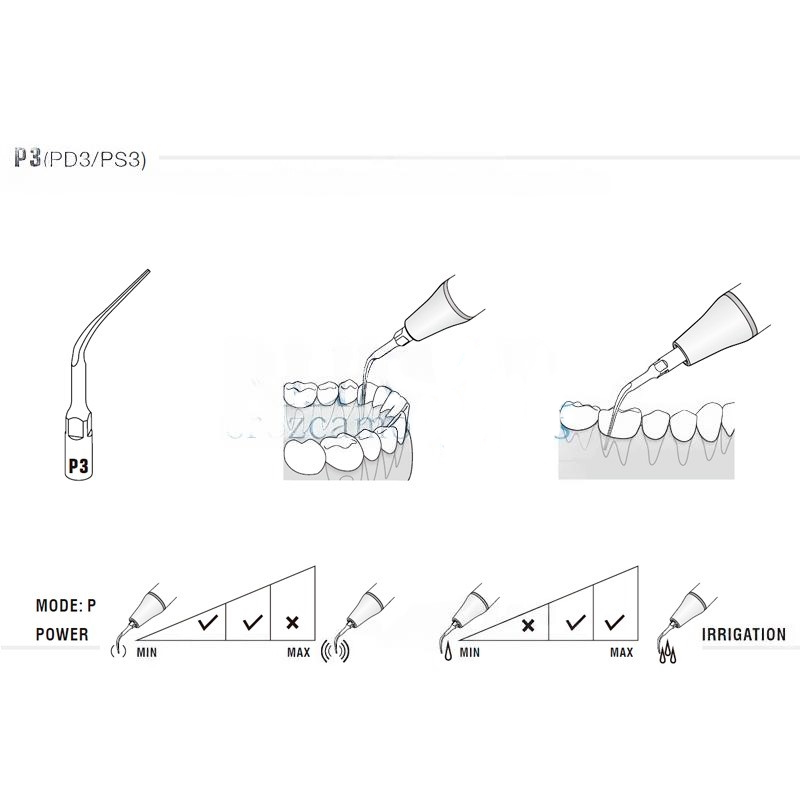 Woodpecker PS3 ultrasonic tip compatible with Sirona | Perio