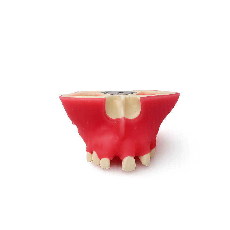 Typodont for Sinus Lift Practice with Gingiva and with Partial Sinus Cavity Bader