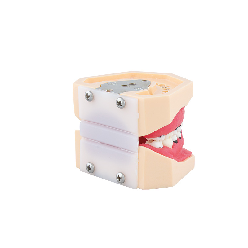 Bader Complete Periodontitis Model
