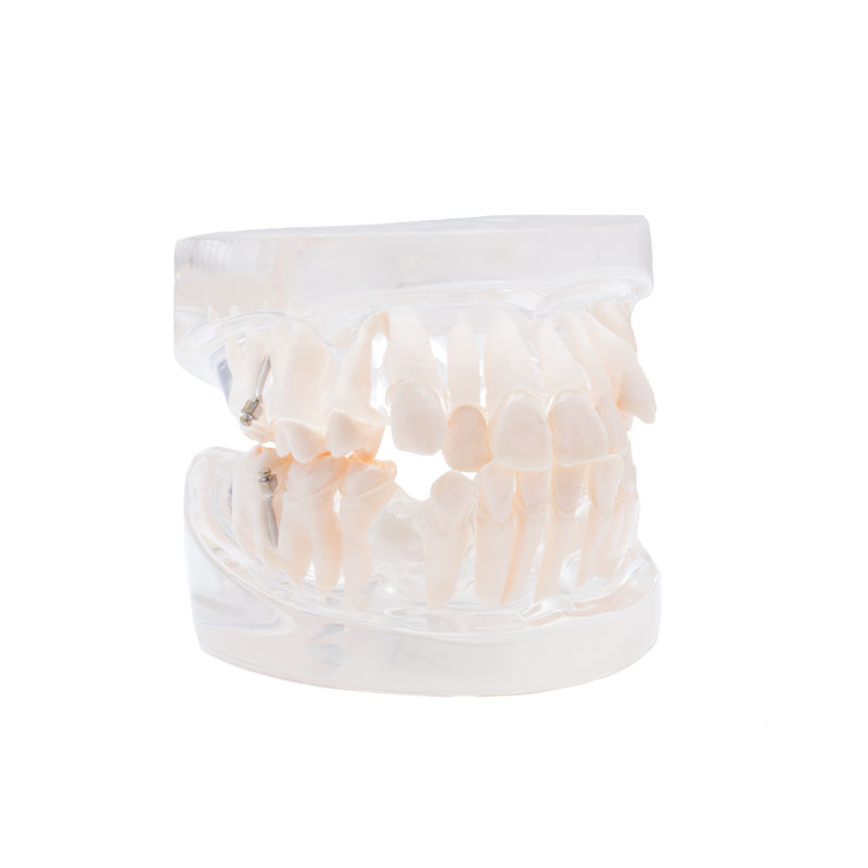 Bader orthodontic practice model