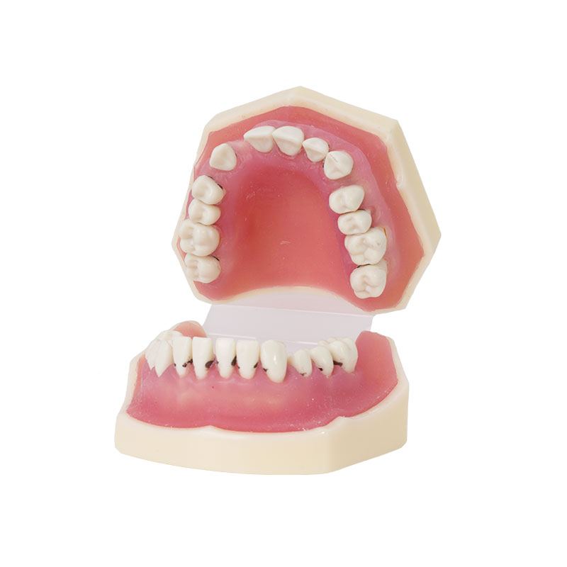 Bader periodontics model