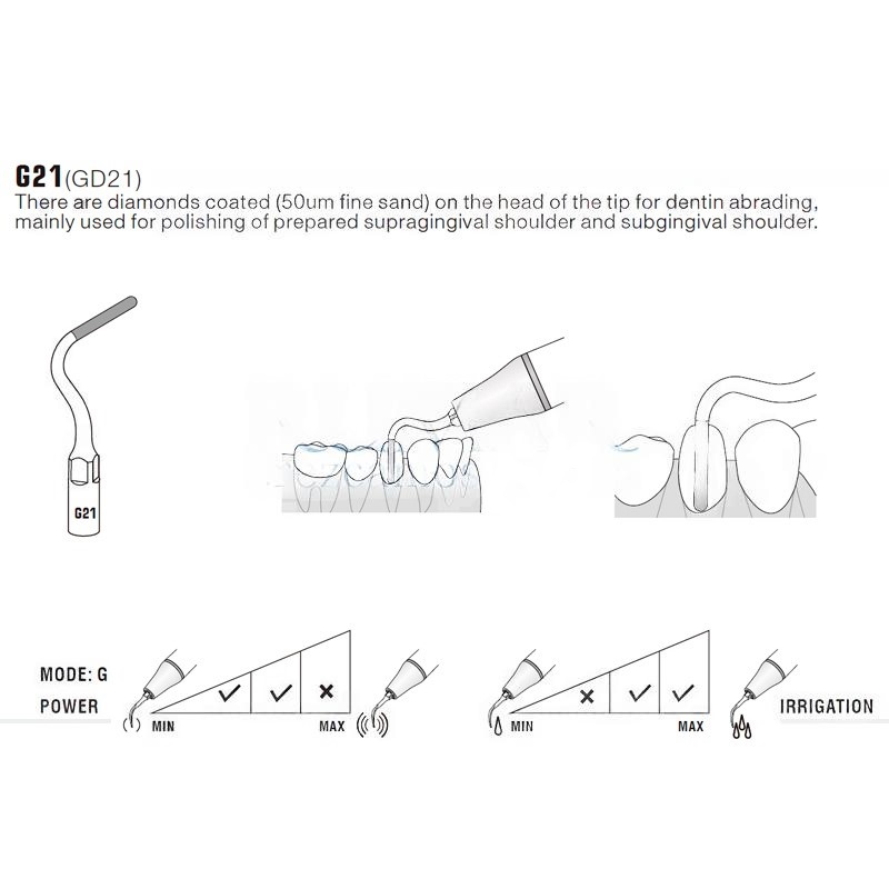 Woodpecker GD21 ultrasonic tip compatible with SATELEC | Prophylaxis, Diamond Carving