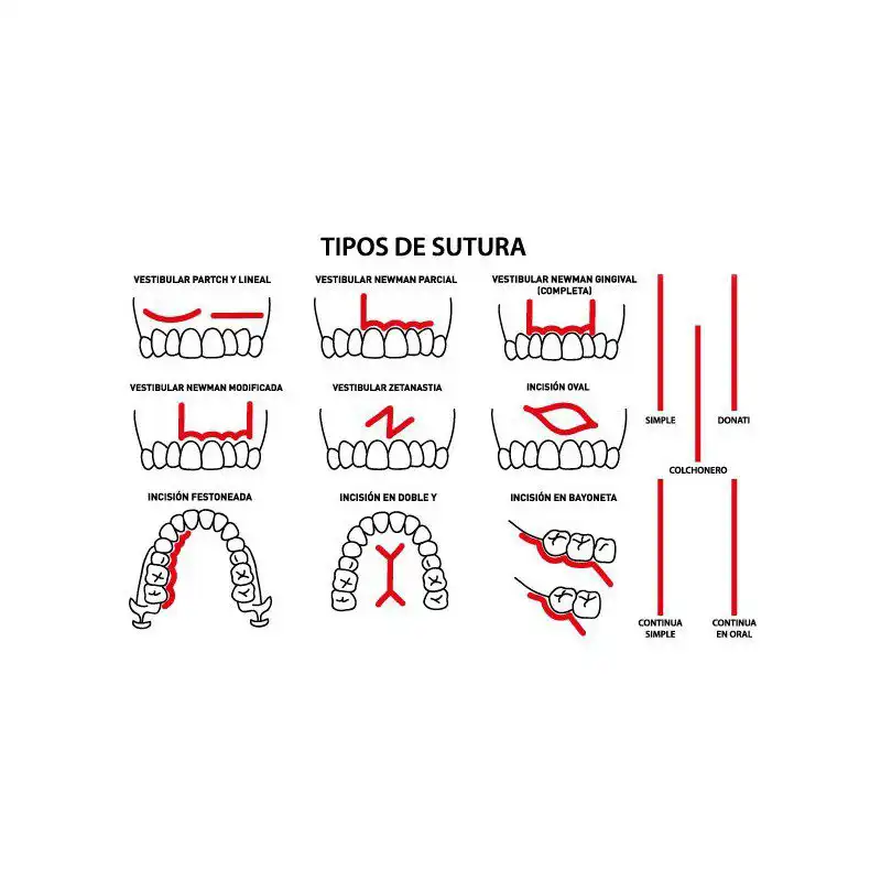 Bader Suture Kit