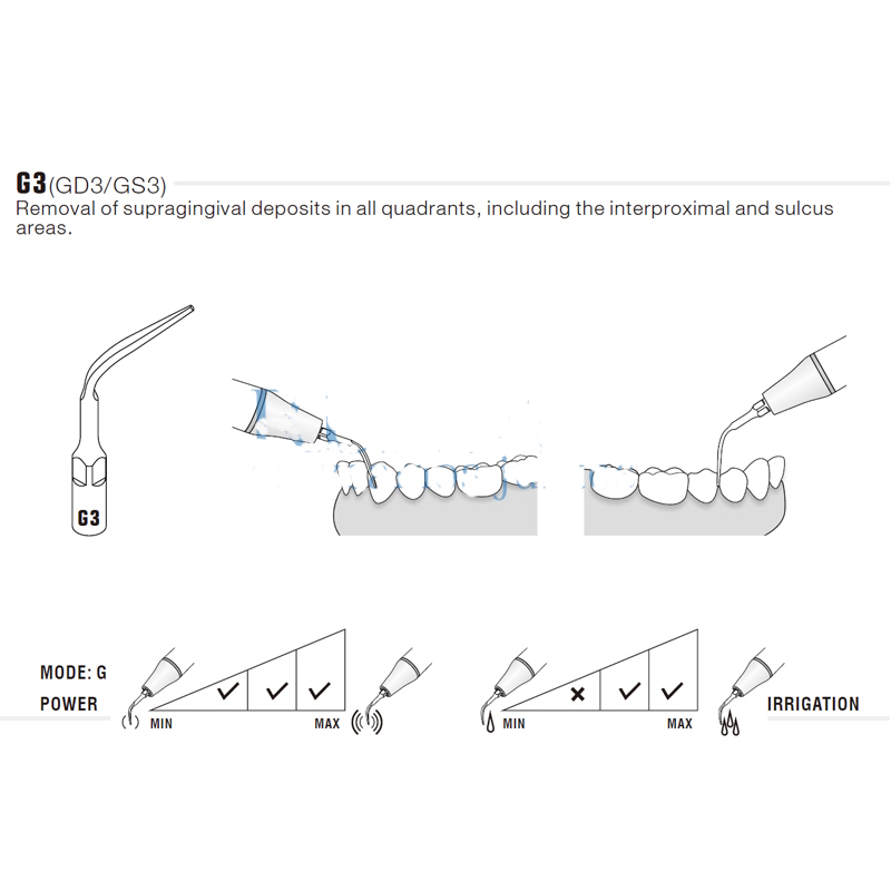 Ultrasonic Tip Woodpecker GD3 Compatible With Satelec | Prophylaxis