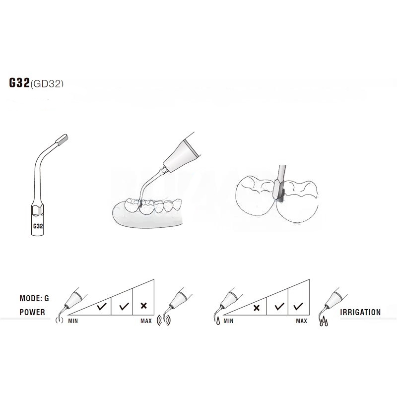Woodpecker G32 ultrasonic tip compatible with EMS | Prophylaxis, Diamond Carving