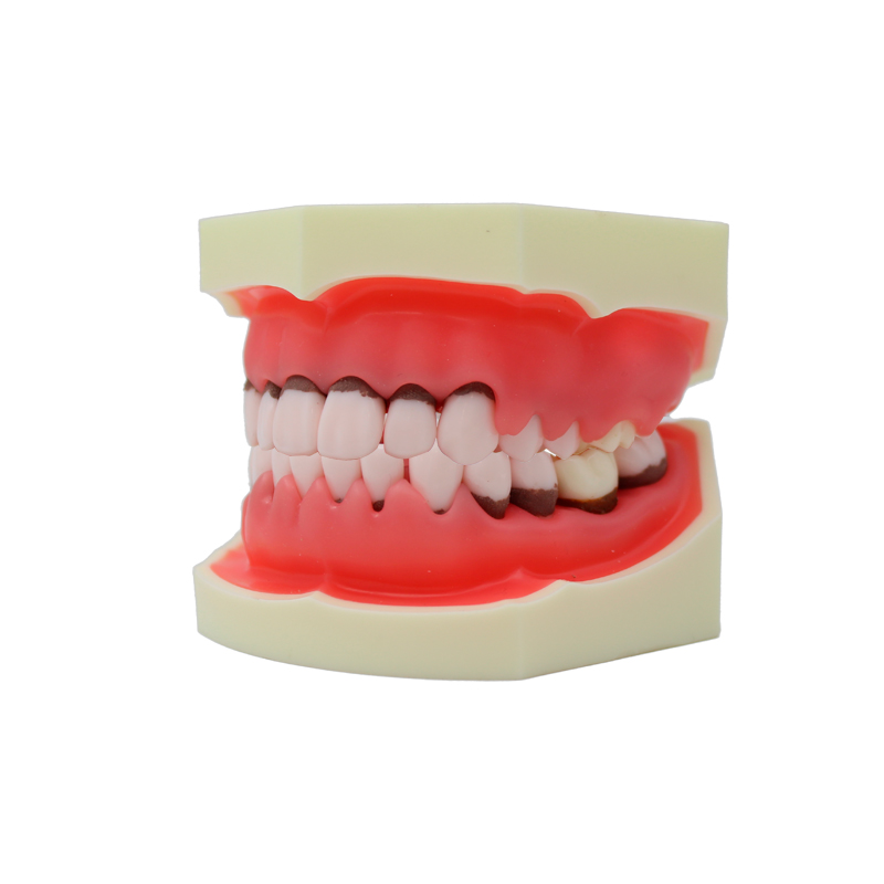 Periodontal typodont without Bader articulator
