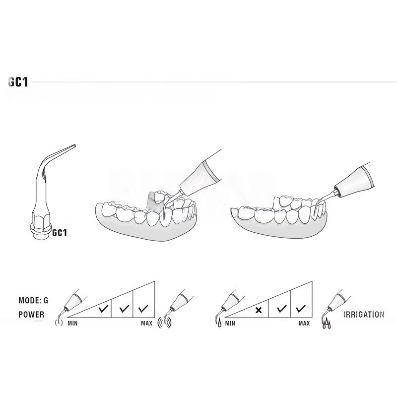 Ultrasonic tip Woodpecker GC1 compatible KaVo | Prophylaxis